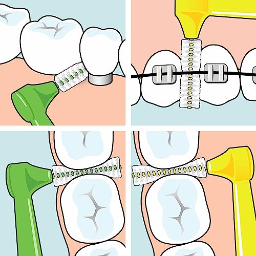 TePe - Scovolino interdentale Angle, 0,5 mm, 6 pezzi