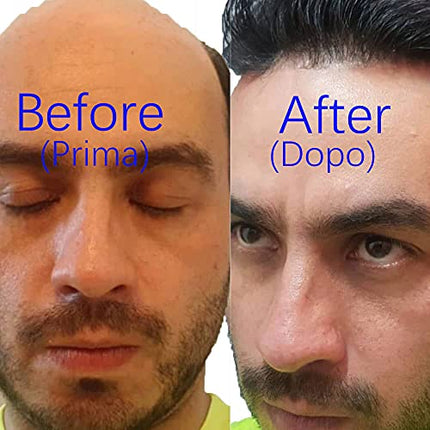 Parrucca Uomo PU Frontale con Pizzo Toupee Pezzi di Capelli Umani Europei per Uomini Protesi Capelli Uomo 8×10 Pollici Sottile Pelle 0,06 Centimetri Spessore Uomini Parrucca in Off Black